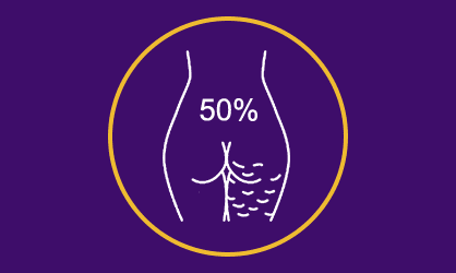 No final do Segundo mês você já irá notar um desaparecimento de 50% da Celulite e uma melhora na circulação sanguínea nas pernas.